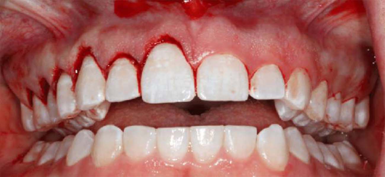 چگونه میتوان بهترین متخصص پریودنتیست را پیدا کرد؟