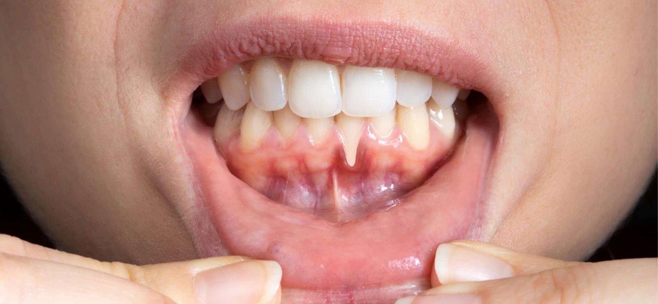 بهترین متخصص لثه در سعادت آباد