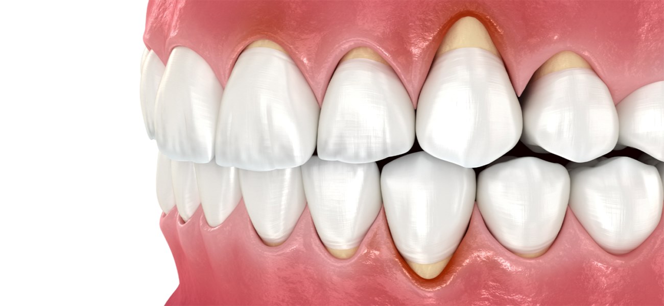 بهترین متخصص لثه در سعادت آباد
