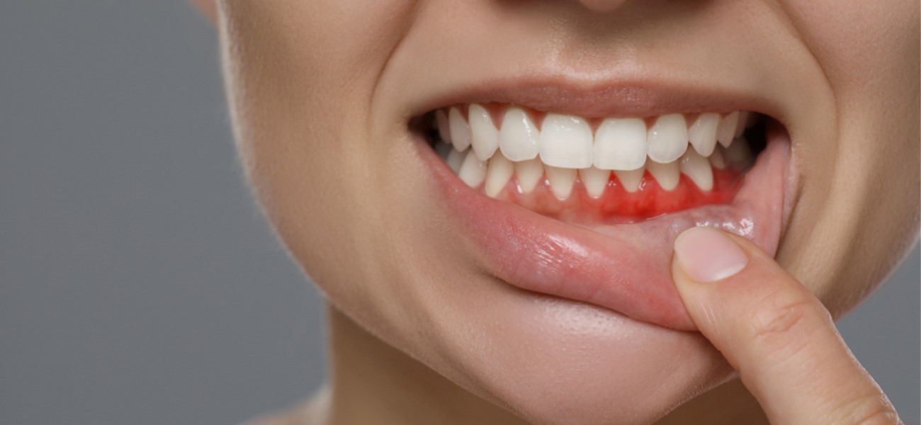 بهترین متخصص لثه در سعادت آباد