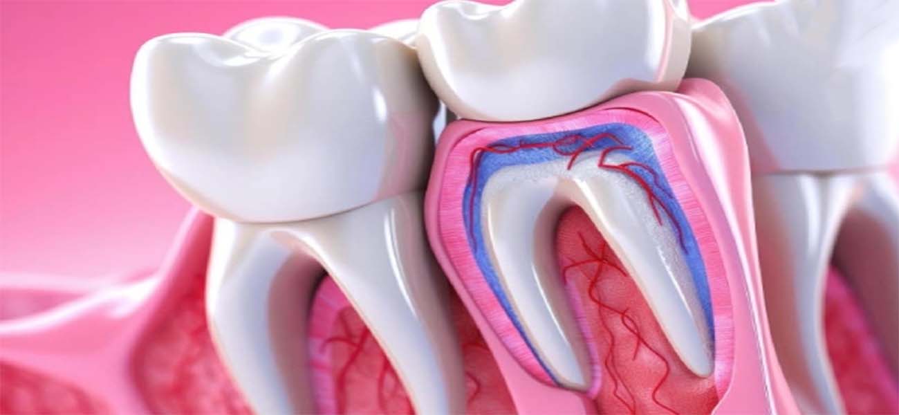 جراحی لثه چیست و چه زمانی لازم است؟